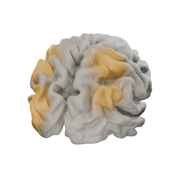 Cortical surface with amber activity regions